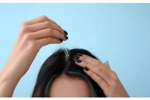 Scalp treatment with natural oils